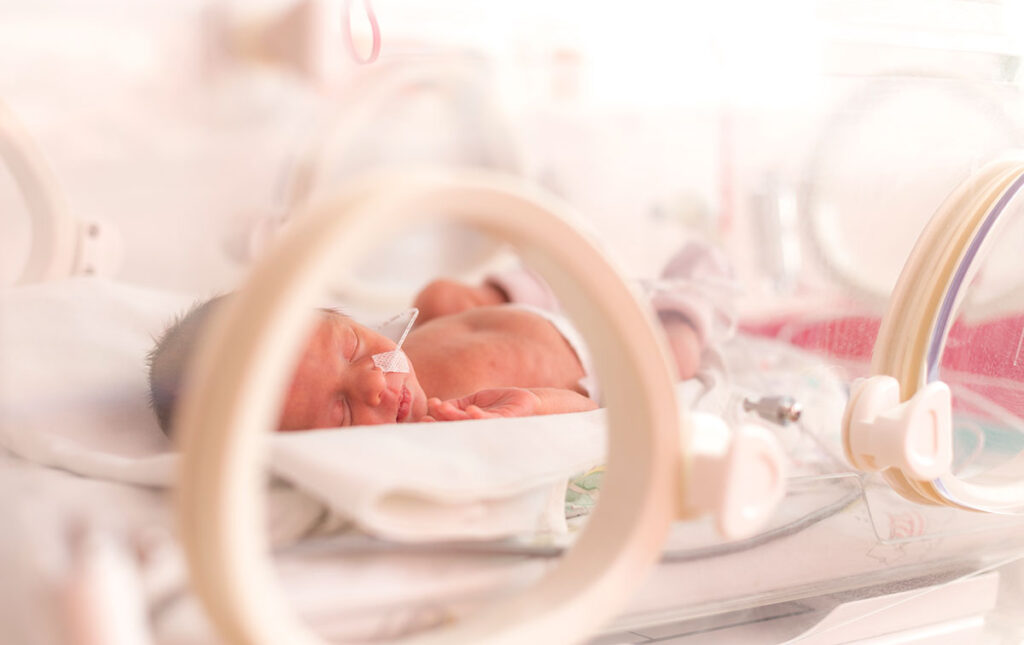 Image of baby in NICU